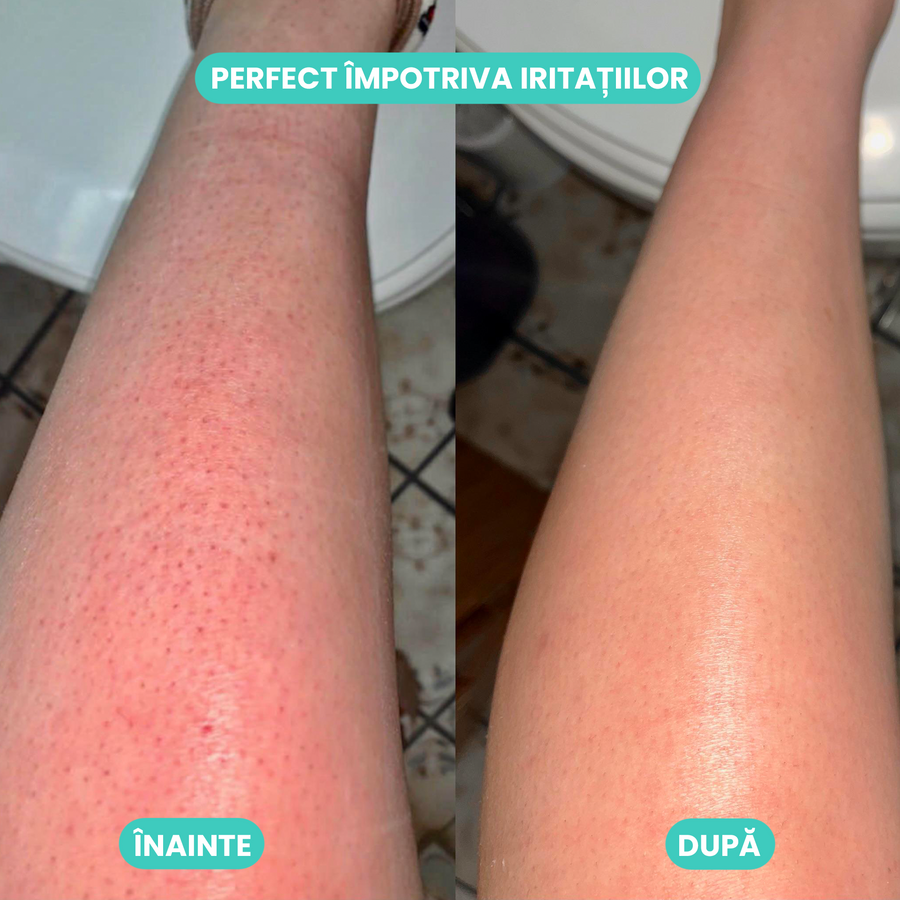 Epilator electric
